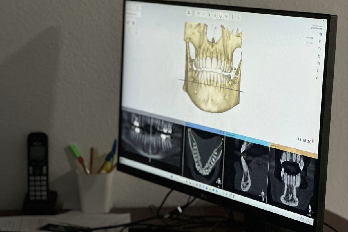 3D imaging for precise dental treatments
